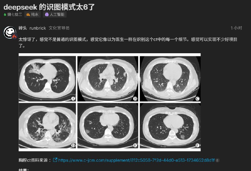 新版DeepSeek识图功能还能读懂CT图DeepSeek V4发布才5天，几乎每天都有新动作，昨天研究人员预告多模态能力即将到来，今天已经有灰度测试